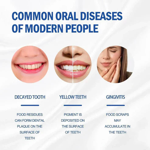 SP-4 Probiotic Brightening & Stain Removing Toothpaste ( pack of 2 )